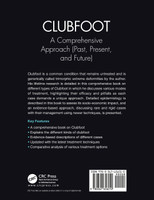Clubfoot