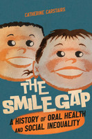 Smile Gap