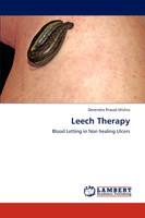 Leech Therapy