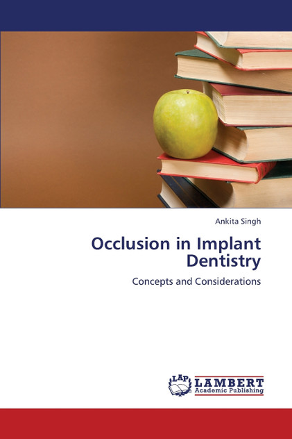 Occlusion in Implant Dentistry