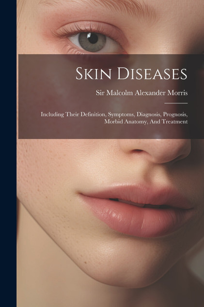 Skin Diseases Skin Diseases