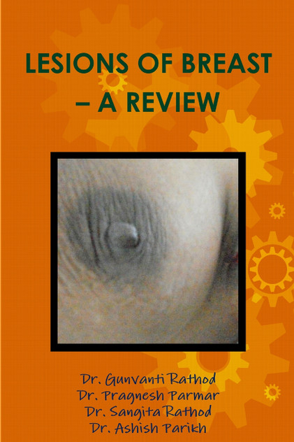 LESIONS OF BREAST - A REVIEW LESIONS OF BREAST - A REVIEW