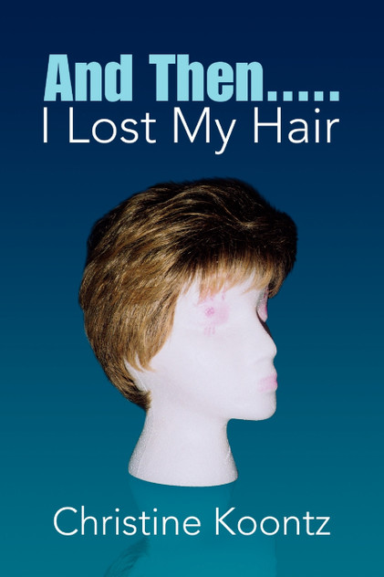 And Then..... I Lost My Hair
