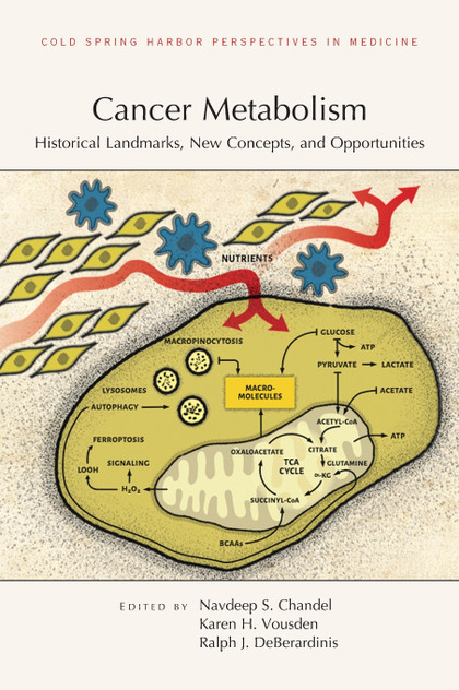 Cancer Metabolism Cancer Metabolism