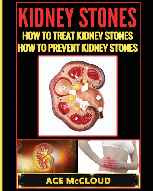 Kidney Stones Kidney Stones