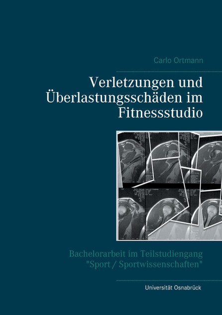 Verletzungen und Überlastungsschäden im Fitnessstudio