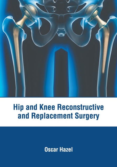Hip and Knee Reconstructive and Replacement Surgery