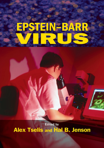 Epstein-Barr Virus Epstein-Barr Virus