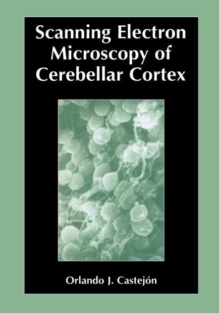 Scanning Electron Microscopy of Cerebellar Cortex Scanning Electron Microscopy of Cerebellar Cortex