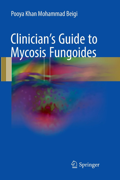 Clinician's Guide to Mycosis Fungoides Clinician's Guide to Mycosis Fungoides