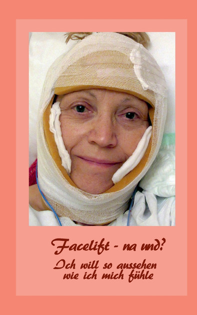 Facelift - na und?