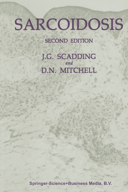 Sarcoidosis Sarcoidosis