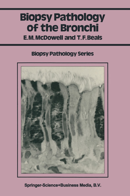 Biopsy Pathology of the Bronchi Biopsy Pathology of the Bronchi