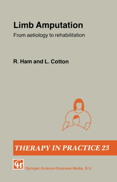 Limb Amputation Limb Amputation