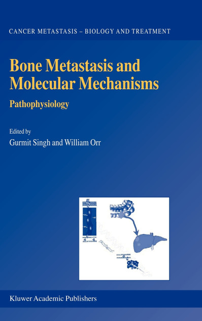 Bone Metastasis and Molecular Mechanisms Bone Metastasis and Molecular Mechanisms
