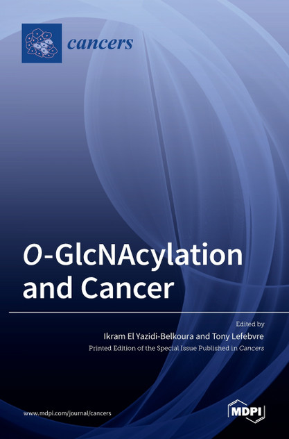 O-GlcNAcylation and Cancer O-GlcNAcylation and Cancer
