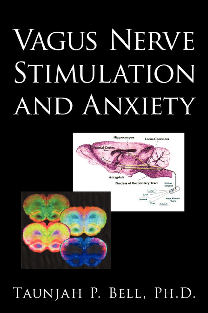 Vagus Nerve Stimulation and Anxiety Vagus Nerve Stimulation and Anxiety