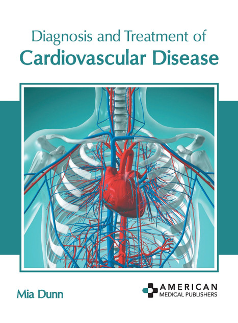 Diagnosis and Treatment of Cardiovascular Disease Diagnosis and Treatment of Cardiovascular Disease