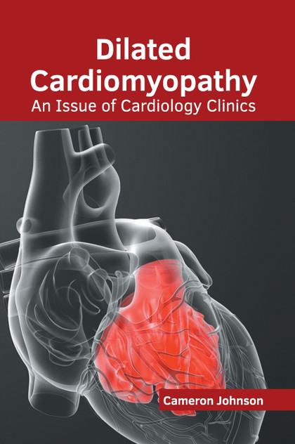 Dilated Cardiomyopathy Dilated Cardiomyopathy