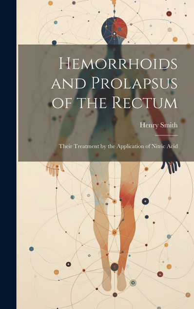 Hemorrhoids and Prolapsus of the Rectum Hemorrhoids and Prolapsus of the Rectum
