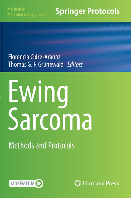Ewing Sarcoma Ewing Sarcoma