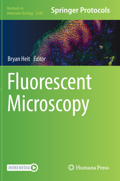 Fluorescent Microscopy Fluorescent Microscopy