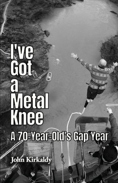 I've Got a Metal Knee