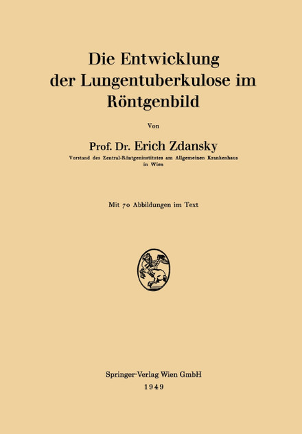 Die Entwicklung Der Lungentuberkulose Im Rontgenbild