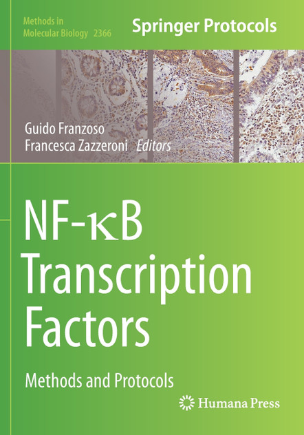 NF-κB Transcription Factors