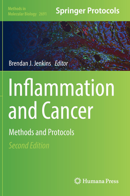 Inflammation and Cancer Inflammation and Cancer