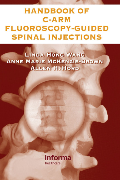 The Handbook of C-Arm Fluoroscopy-Guided Spinal Injections The Handbook of C-Arm Fluoroscopy-Guided Spinal Injections