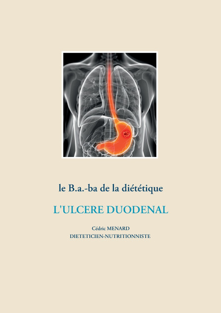 Le b.a.-ba de la diététique pour l'ulcère duodénal Le b.a.-ba de la diététique pour l'ulcère duodénal