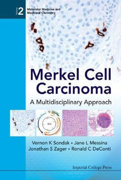 Merkel Cell Carcinoma : A Multidisciplinary Approach Merkel Cell Carcinoma : A Multidisciplinary Approach
