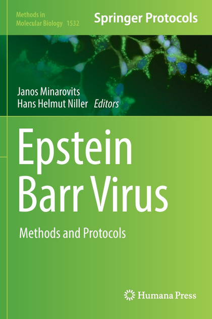 Epstein Barr Virus Epstein Barr Virus