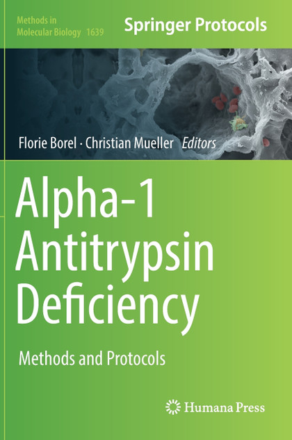 Alpha-1 Antitrypsin Deficiency Alpha-1 Antitrypsin Deficiency