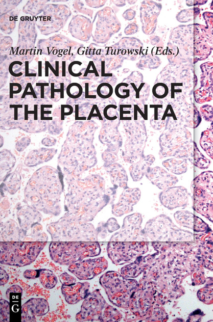 Clinical Pathology of the Placenta Clinical Pathology of the Placenta