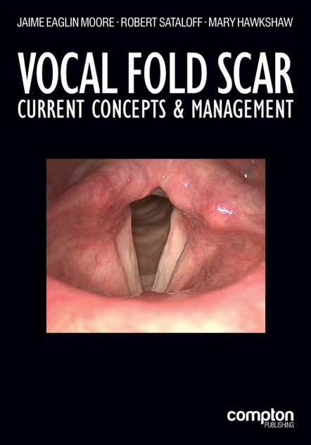 Vocal Fold Scar Vocal Fold Scar