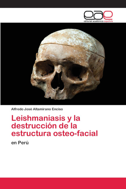 Leishmaniasis y la destrucción de la estructura osteo-facial