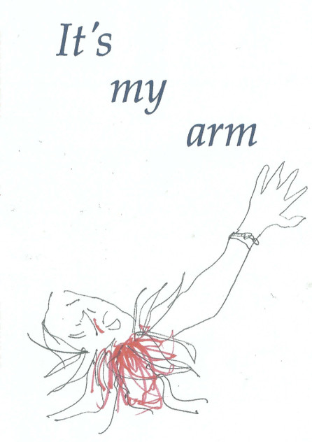 It's my arm It's my arm