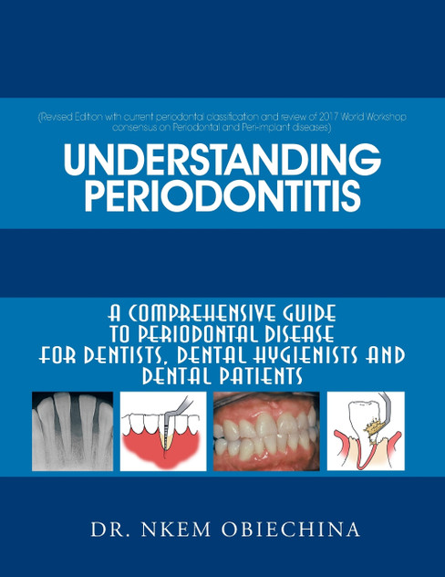 Understanding Periodontitis Understanding Periodontitis