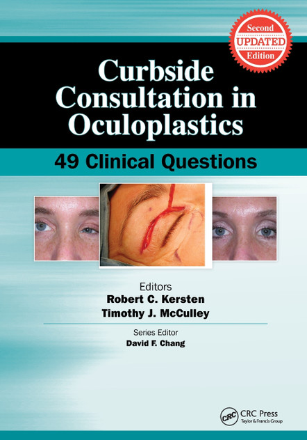 Curbside Consultation in Oculoplastics Curbside Consultation in Oculoplastics