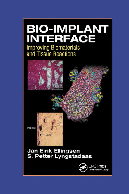 Bio-Implant Interface