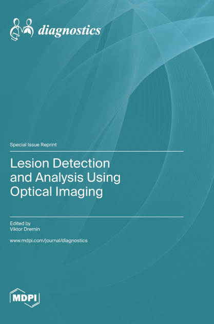 Lesion Detection and Analysis Using Optical Imaging