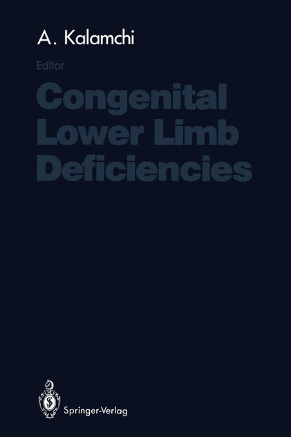Congenital Lower Limb Deficiencies Congenital Lower Limb Deficiencies