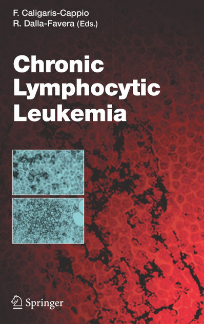 Chronic Lymphocytic Leukemia Chronic Lymphocytic Leukemia