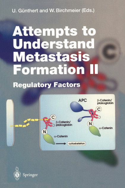 Attempts to Understand Metastasis Formation II Attempts to Understand Metastasis Formation II
