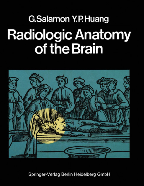 Radiologic Anatomy of the Brain Radiologic Anatomy of the Brain
