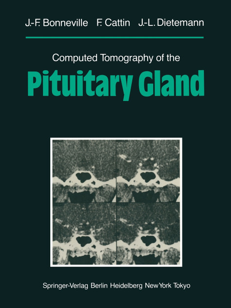Computed Tomography of the Pituitary Gland Computed Tomography of the Pituitary Gland