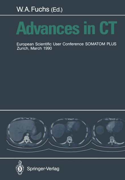 Advances in CT Advances in CT