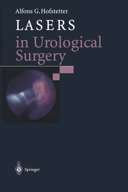 Lasers in Urological Surgery Lasers in Urological Surgery